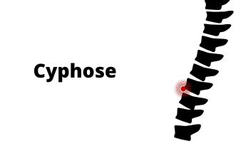Bannière Cyphose