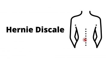 Hernie Discale