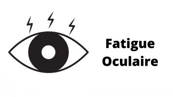 Fatigue oculaire/visuelle et solutions ergonomiques